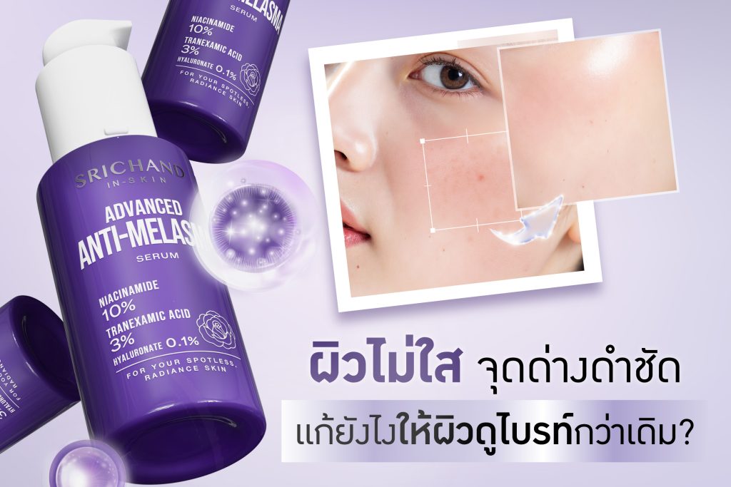 รวมวิธีลดฝ้า จุดด่างดำ ให้ผิวดูกระจ่างใสขึ้น พร้อมแนะนำเซรั่มศรีจันทร์ขวดม่วง